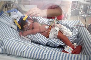 A premature baby wearing an eye mask lays in a neontal cot.