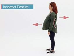 A pregnant women stands in an incorrect posture with an arched low back .
