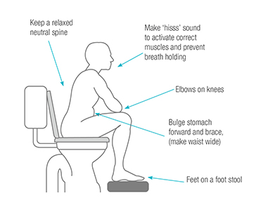 A line drawing of a person sitting in the correct position for toileting. Text advises to keep a relaxed neutral spine, feet on a foot stool and elbows on knees. Figure has stomach bulged forward and indicates a person should make a hiss sound to activate the correct posture.